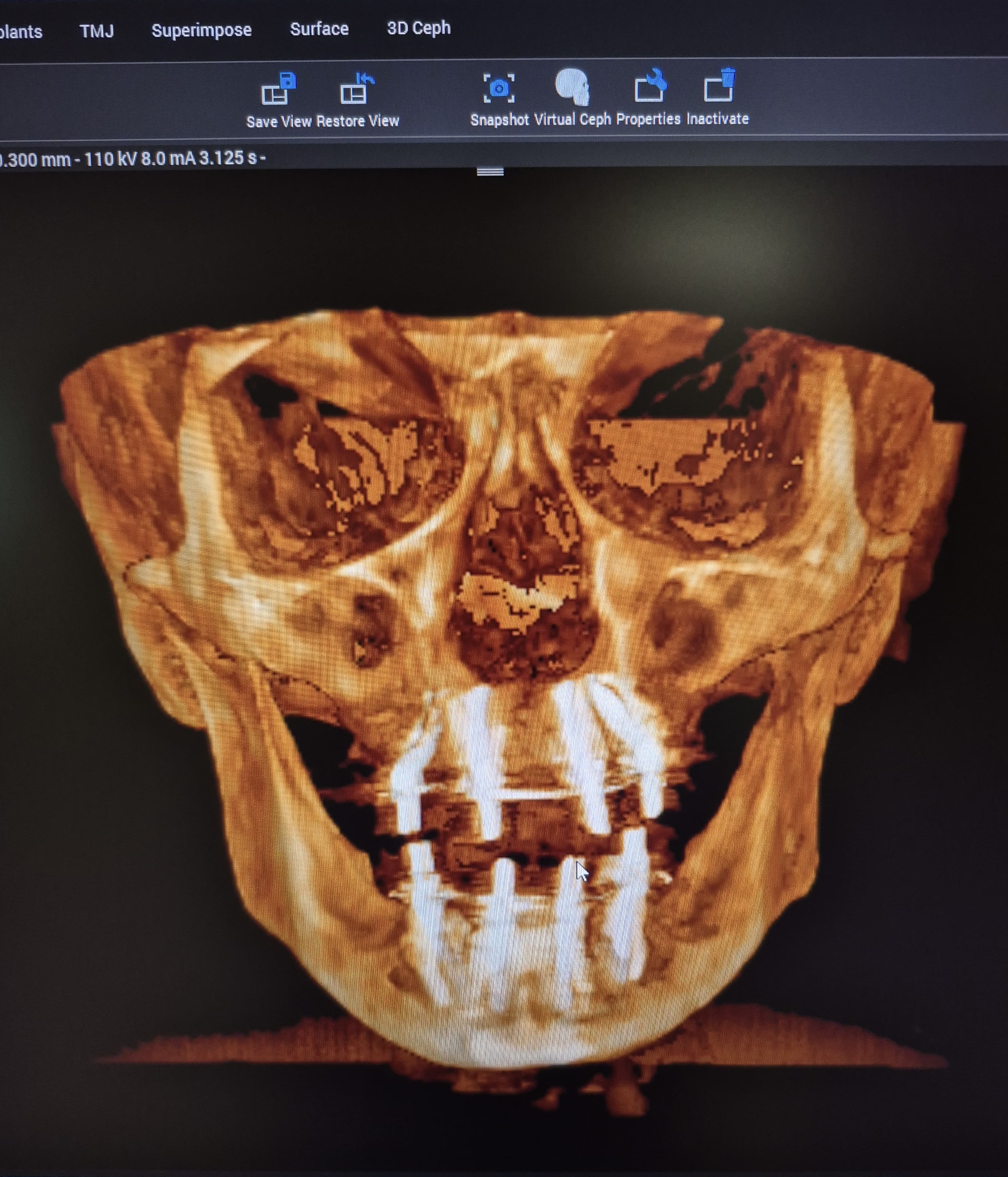 Digital dentistry workflow